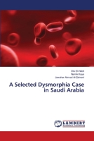 A Selected Dysmorphia Case in Saudi Arabia 3659414328 Book Cover
