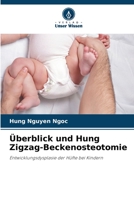 Überblick und Hung Zigzag-Beckenosteotomie 6205353237 Book Cover