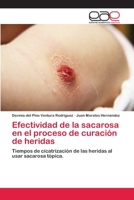 Efectividad del uso de la sacarosa en la de cicatrización de heridas: Tiempos de cicatrización de las heridas al usar sacarosa tópica. 6202097051 Book Cover