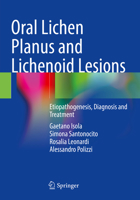 Oral Lichen Planus and Lichenoid Lesions: Etiopathogenesis, Diagnosis and Treatment 3031297644 Book Cover