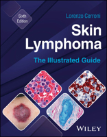 Skin Lymphoma: The Illustrated Guide 1394235488 Book Cover