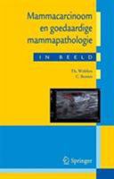Mammacarcinoom En Goedaardige Mammapathologie in Beeld: Casu�stiek in Een Breder Perspectief 903136262X Book Cover