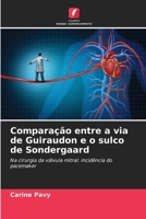 Comparação entre a via de Guiraudon e o sulco de Sondergaard (Portuguese Edition) 6209744184 Book Cover