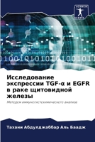 ???????????? ?????????? TGF-a ? EGFR ? ???? ?????????? ??????: ??????? ?????????????????????? ??????? (Russian Edition) 6207677846 Book Cover