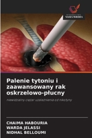 Palenie tytoniu i zaawansowany rak oskrzelowo-plucny 6630191862 Book Cover