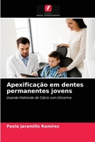 Apexificação em dentes permanentes jovens 6203638188 Book Cover