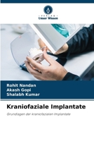 Kraniofaziale Implantate (German Edition) 6209882889 Book Cover