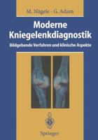 Moderne Kniegelenkdiagnostik: Bildgebende Verfahren Und Klinische Aspekte 3642786286 Book Cover