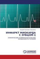 Infarkt Miokarda S Zubtsom Q 3844351574 Book Cover
