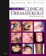 Atlas of clinical dermatology 0397447892 Book Cover