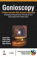 Gonioscopy: A Video Assisted Skill Transfer Approach 9352501918 Book Cover