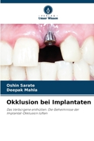 Okklusion bei Implantaten: Das Verborgene enthüllen: Die Geheimnisse der Implantat-Okklusion lüften 6206119831 Book Cover