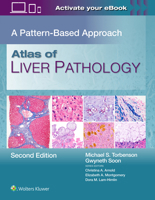 Atlas of Liver Pathology: A Pattern-Based Approach 1975240111 Book Cover