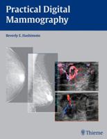 Practical Digital Mammography 3131480416 Book Cover