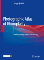 Photographic Atlas of Rhinoplasty: Problem-solving and Troubleshooting 3030443248 Book Cover