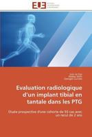 Evaluation Radiologique d'un Implant Tibial en Tantale Dans les Ptg 3841792979 Book Cover