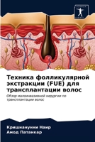 Техника фолликулярной экстракции (FUE) для трансплантации волос: Обзор малоинвазивной хирургии по трансплантации волос 620353613X Book Cover