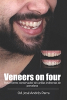 Veneers on four: Tratamiento conservador de carillas indirectas de porcelana 1701691280 Book Cover