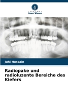 Radiopake und radioluzente Bereiche des Kiefers (German Edition) 6209515533 Book Cover