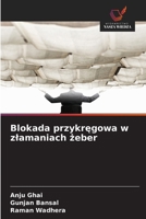 Blokada przykregowa w zlamaniach zeber (Polish Edition) 6208784417 Book Cover