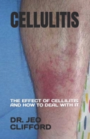 CELLULITIS: THE EFFECT OF CELLILITIS AND HOW TO DEAL WITH IT B0C8RZLVDM Book Cover