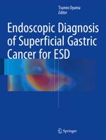 Endoscopic Diagnosis of Superficial Gastric Cancer for ESD 4431544682 Book Cover