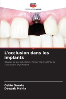 L'occlusion dans les implants: Révéler ce qui est caché : Percer les mystères de l'occlusion implantaire 6206119858 Book Cover
