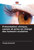 Présentation clinique, causes et prise en charge des tumeurs oculaires (French Edition) 6208315573 Book Cover